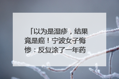 以为是湿疹，结果竟是癌！宁波女子悔惨：反复涂了一年药膏都没好！很多患者首诊都去了皮肤科